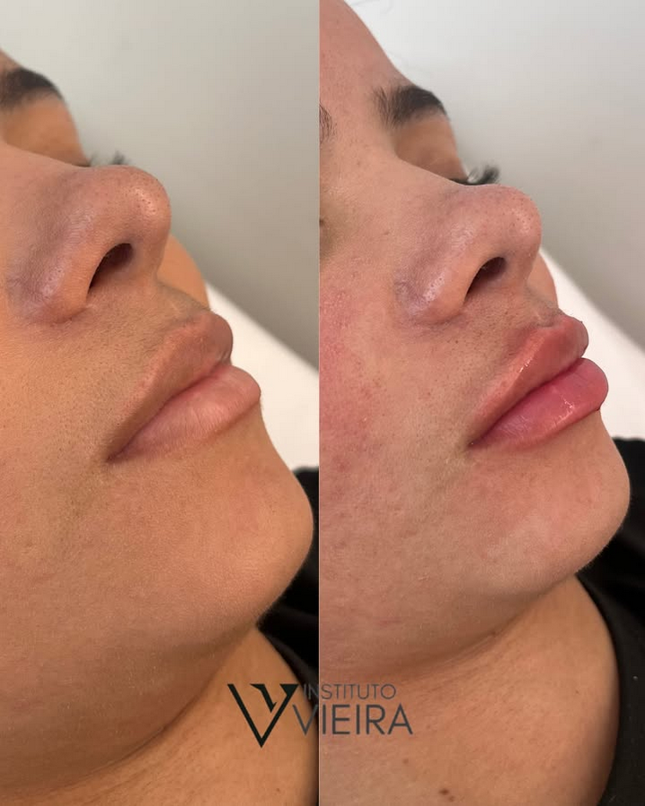 Harmonização Facial e Corporal